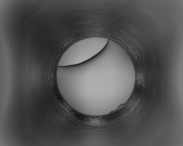 X0000088140618200705141033