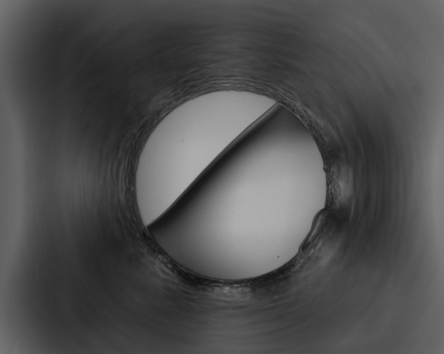 X0000088140619200705141033