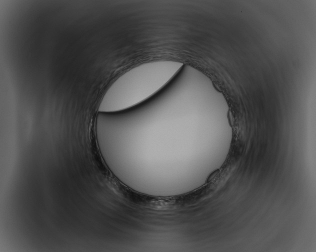 X0000088140660200705141033