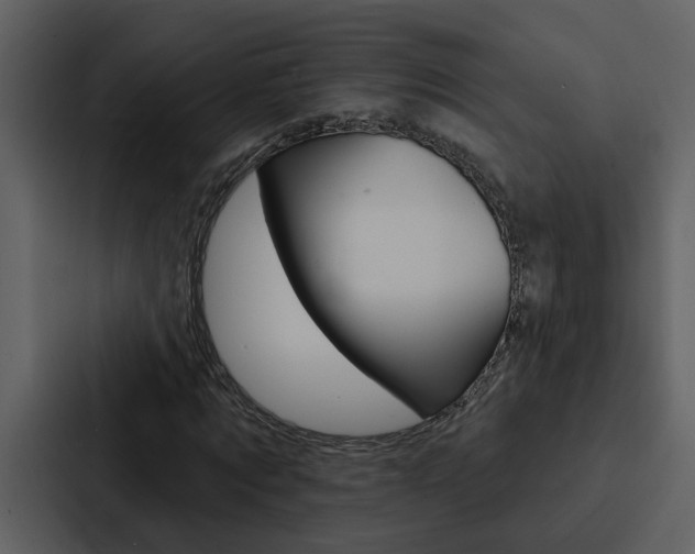 X0000088140869200705141030