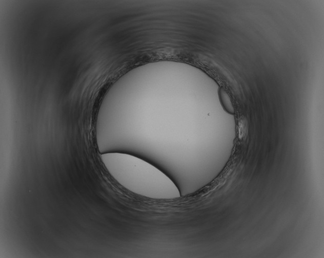 X0000088141011200705141027