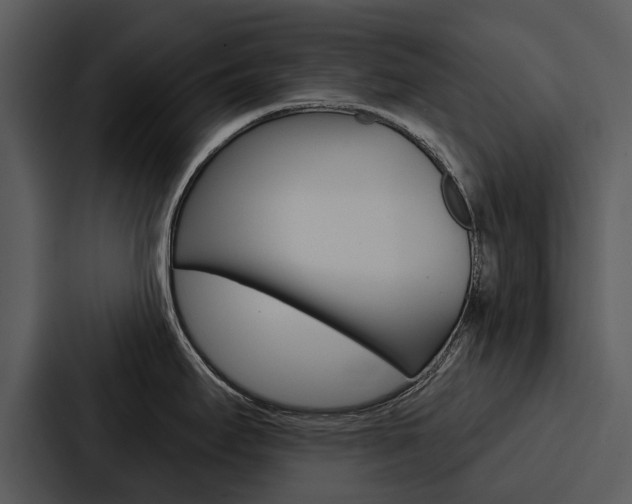 X0000088141295200705141024