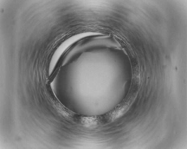 X0000088140139200705141520