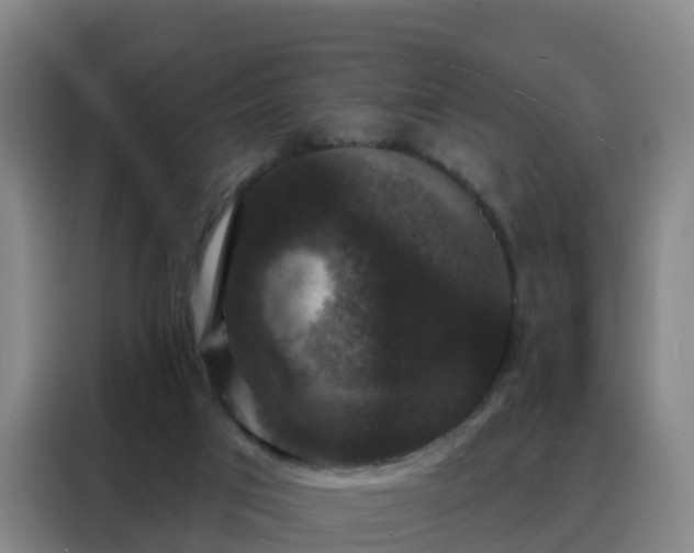 X0000088140017200705211145