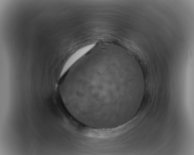 X0000088140033200705211145