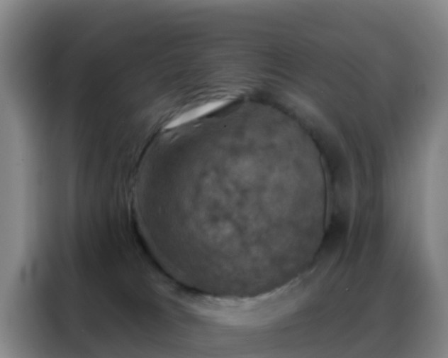 X0000088140037200705211144