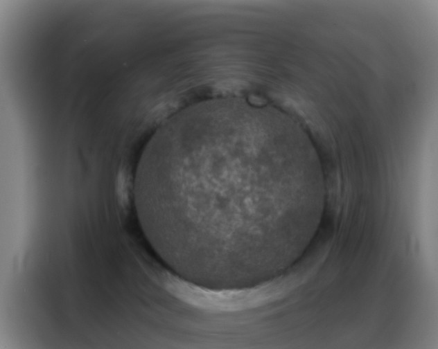 X0000088140038200705211144