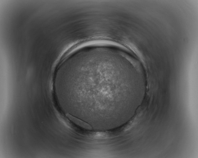 X0000088140060200705211144