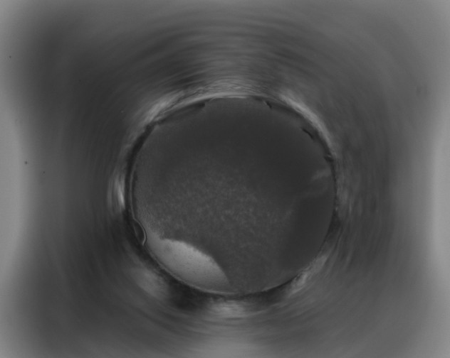 X0000088140062200705211144