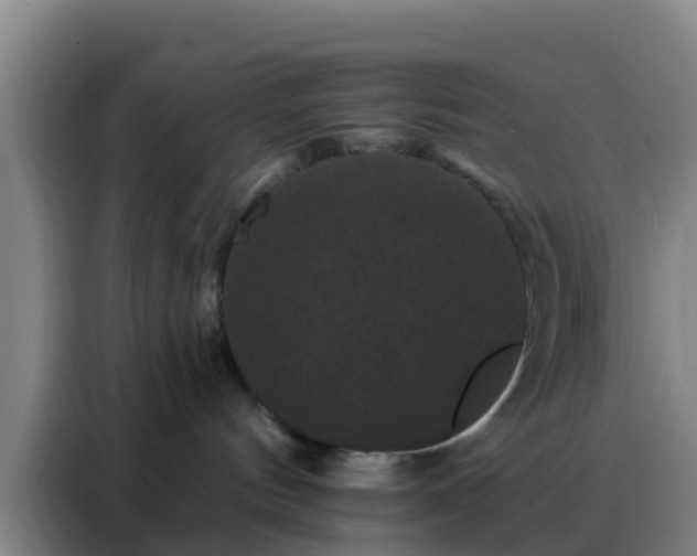 X0000088140144200705211143