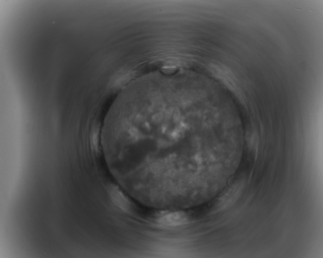 X0000088140185200705211143