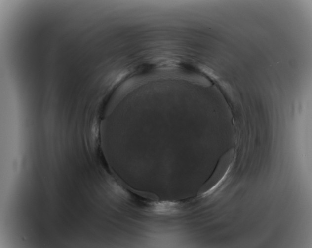 X0000088140192200705211143