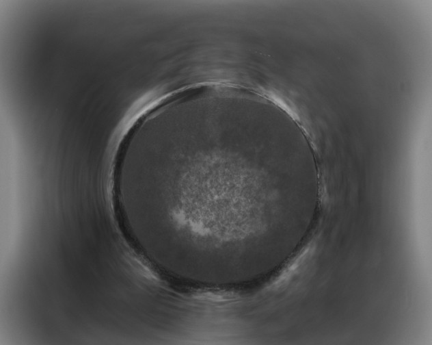 X0000088140199200705211142