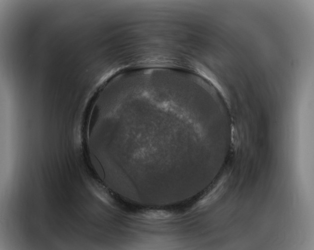 X0000088140203200705211142