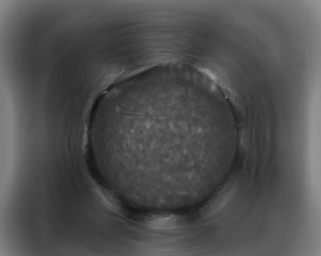 X0000088140206200705211142