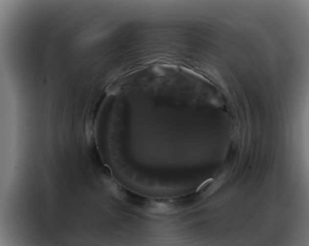 X0000088140285200705211142