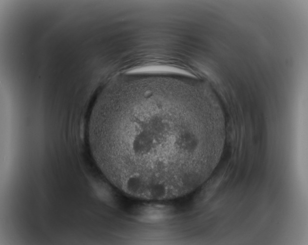 X0000088140315200705211141