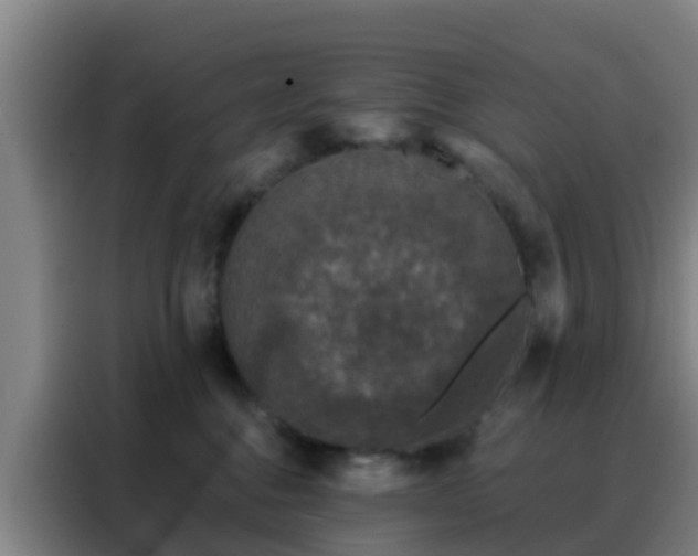 X0000088140376200705211140