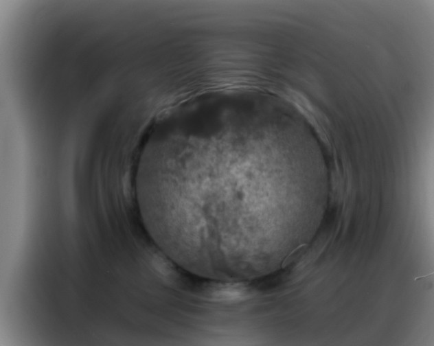 X0000088140377200705211140