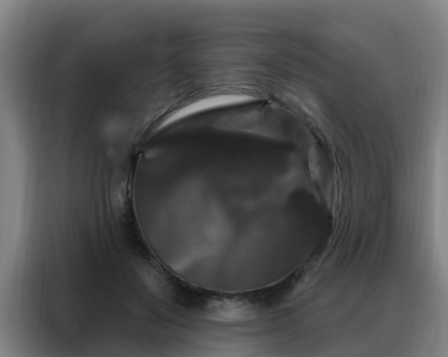 X0000088140503200705211138