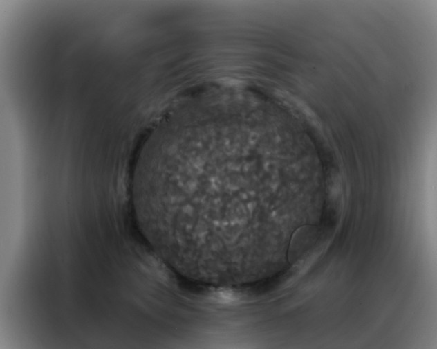 X0000088140565200705211138