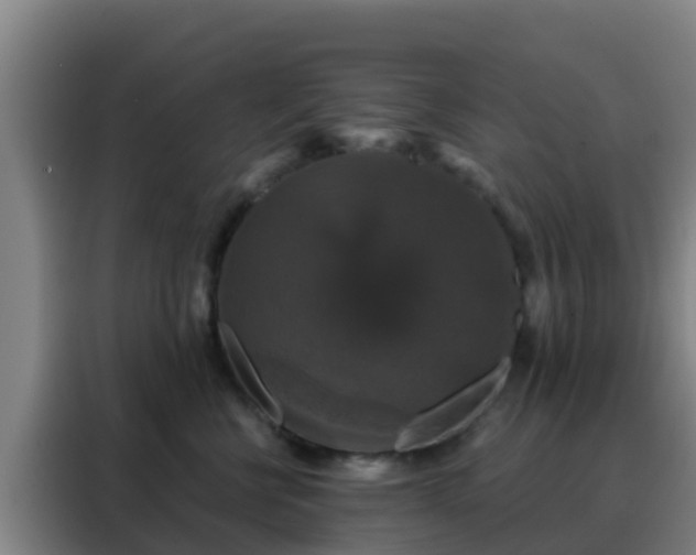 X0000088140570200705211138