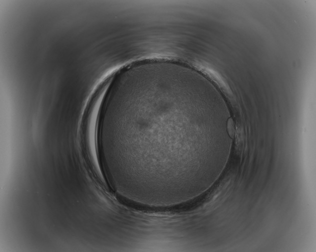 X0000088140628200705211136