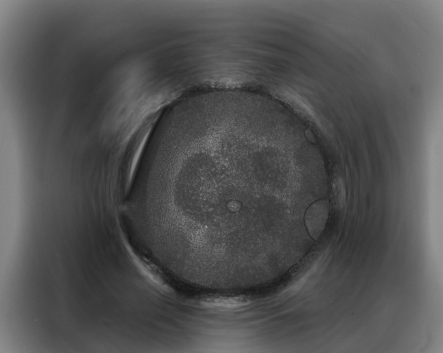 X0000088140638200705211136