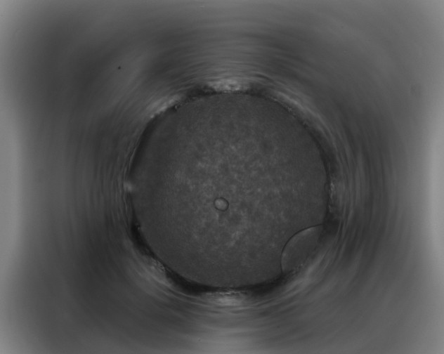 X0000088140652200705211137