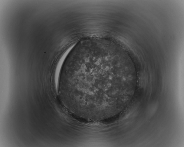 X0000088140695200705211136