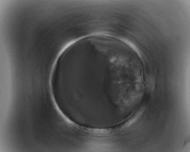 X0000088141007200705211132