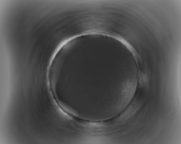 X0000088141102200705211131