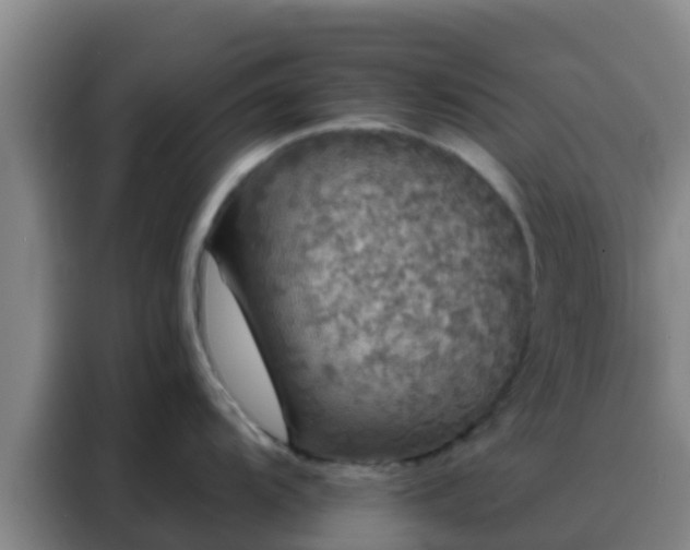 X0000088141104200705211131