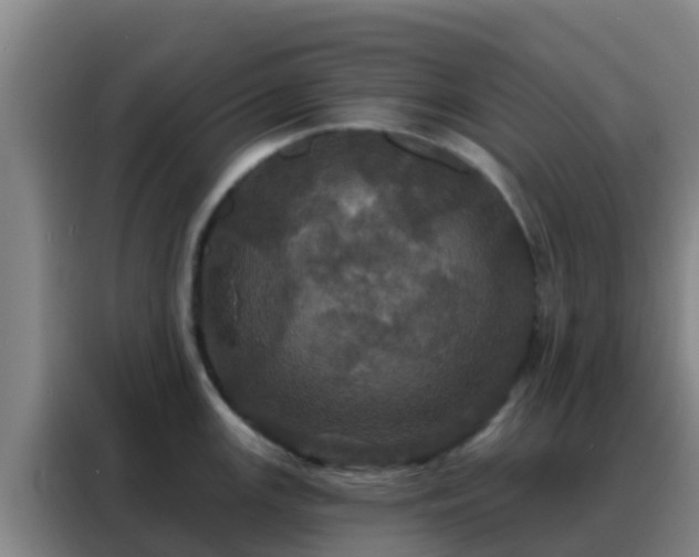 X0000088141147200705211130