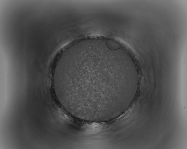 X0000088141207200705211129