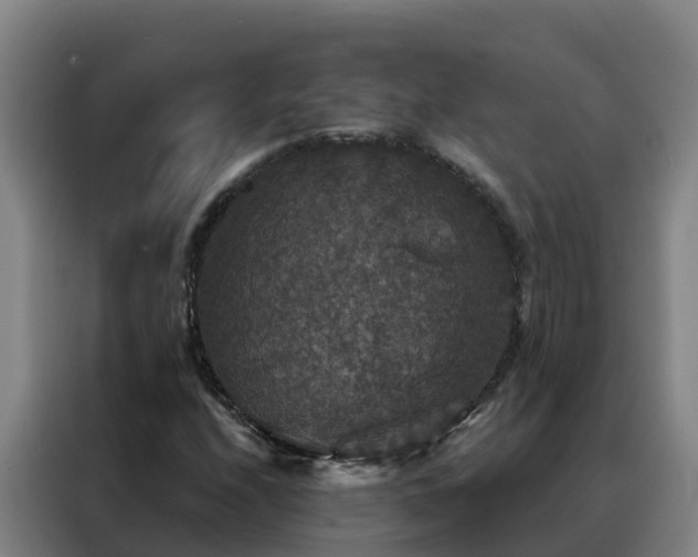 X0000088141208200705211129
