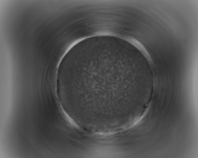 X0000088141244200705211129