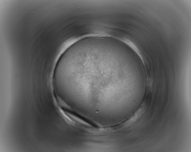 X0000088141485200705211126