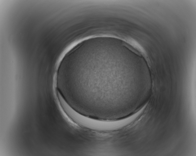 X0000088141528200705211125