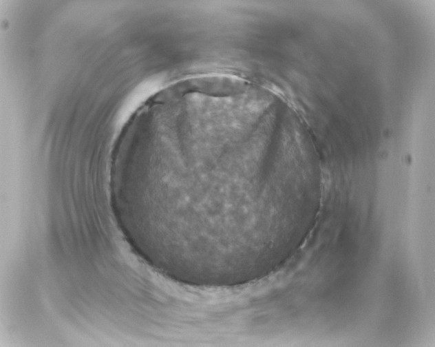 X0000088140006200705291409