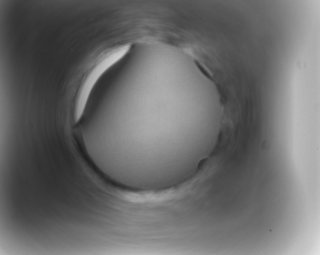 X0000088140005200706041345