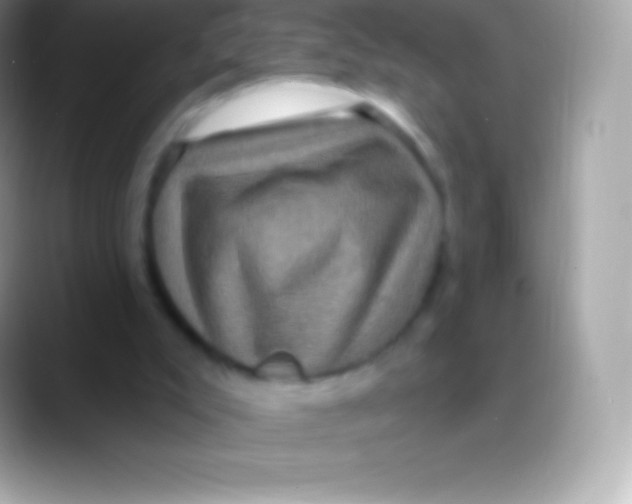 X0000088140007200706041345