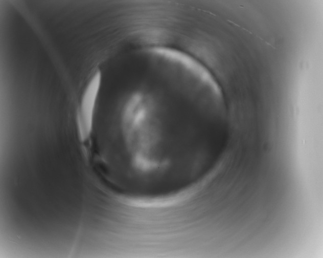 X0000088140017200706041345