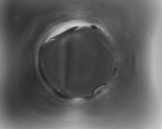 X0000088140055200706041344