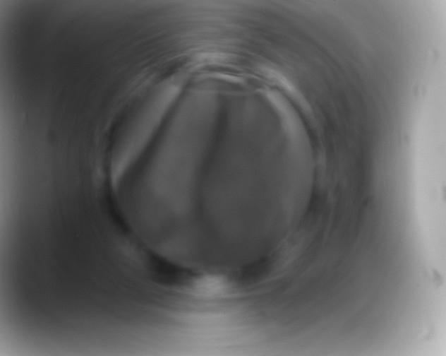 X0000088140114200706041344