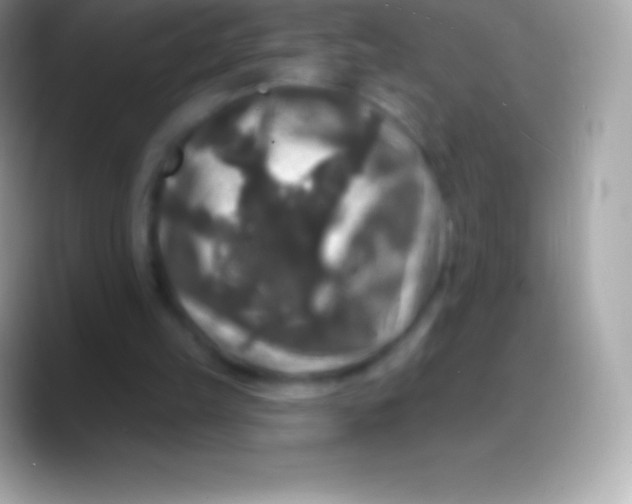 X0000088140149200706041343