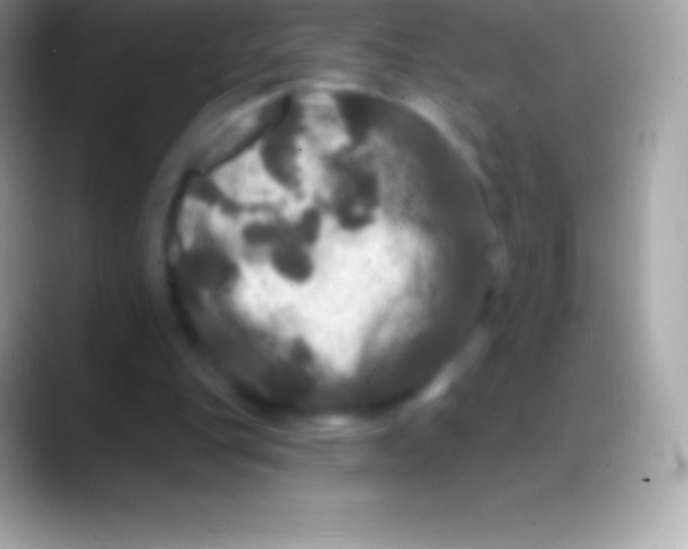 X0000088140151200706041343