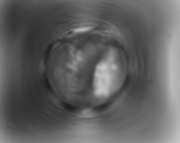 X0000088140173200706041343