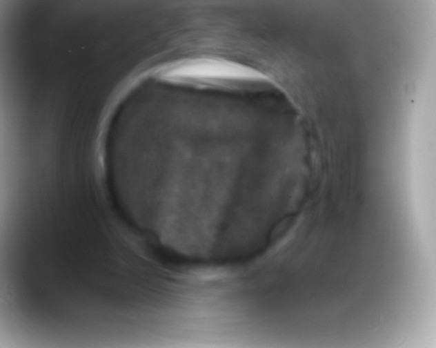 X0000088140246200706041342