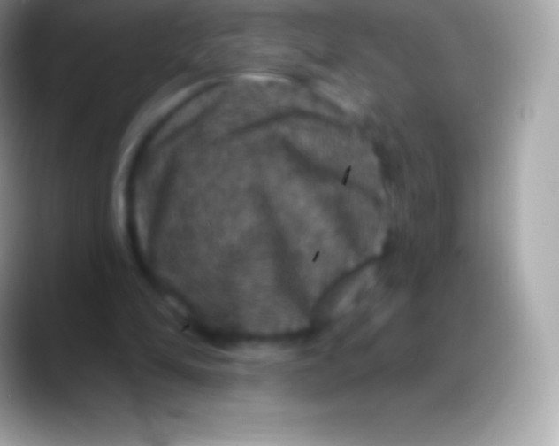 X0000088140294200706041342